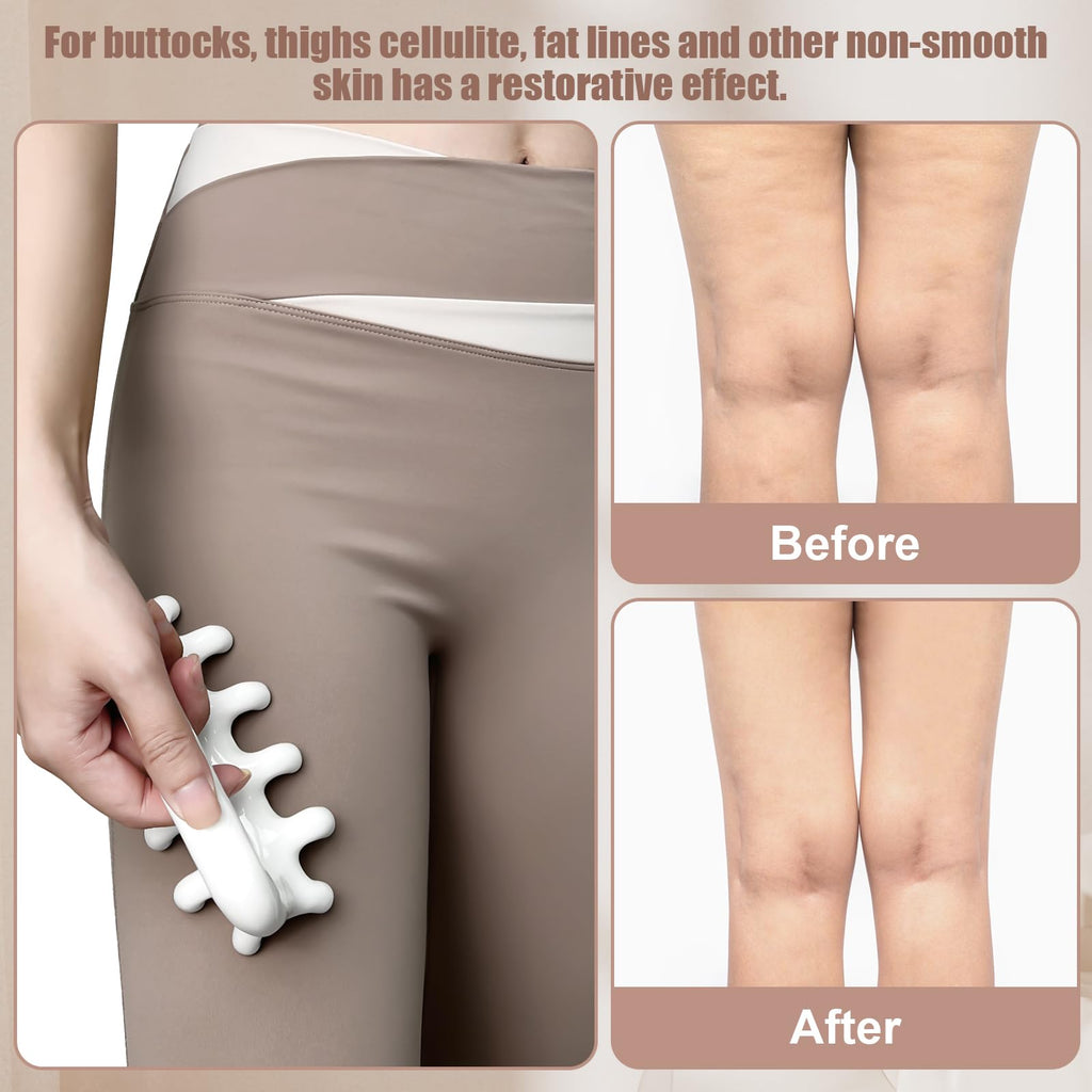 Vemoky Fascia Massage Tool Trigger Point Massage Tools Anti Blaster for Cellulite Massager Tool Reaching Deep Myofascial Tissue Throughout The Body Release Muscle Knot Reduction Cellulite - Fredhappy